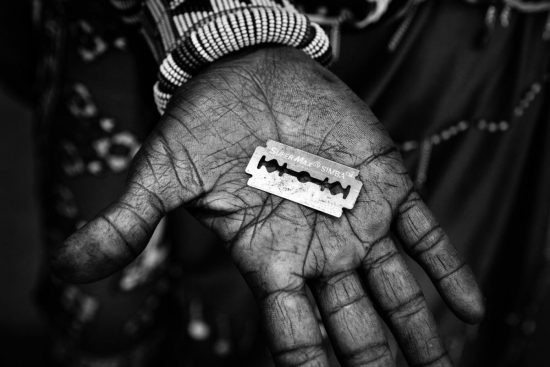 UNICEF :200 εκατομμύρια γυναίκες θύματα της κλειτοριδεκτομής