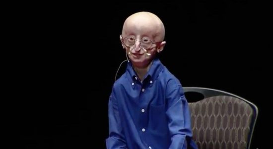 Sam Berns: H φιλοσοφία για μία καλύτερη ζωή (Video)