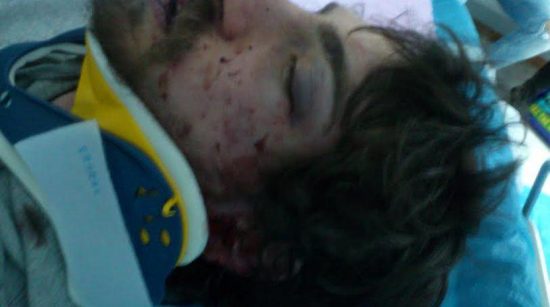 Ποινική δίωξη στον Χρυσαυγίτη που συνελήφθη για τον ξυλοδαρμό του 20χρονου σπουδαστή