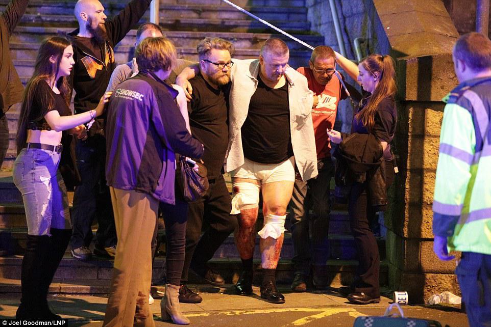 40AE2C1600000578-4531940-Concert_goers_helped_injured_people_make_their_way_from_the_gig_-a-50_1495492948328
