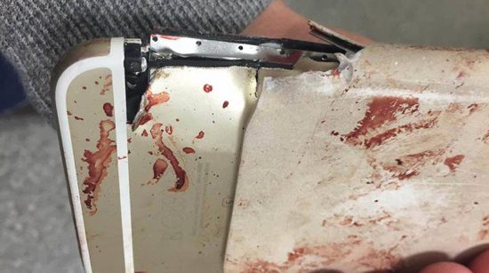 Απίστευτο: Γυναίκα στο Μάντσεστερ γλίτωσε τον θάνατο λόγω του κινητού της (pics)
