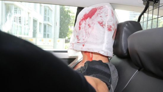 Επίθεση με μαχαίρι σε σούπερ μάρκετ στο Αμβούργο – Ένας νεκρός, συνελήφθη ο δράστης (pics)