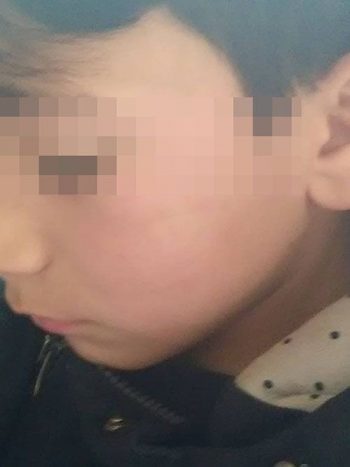 Φυλή: Δάσκαλος χτύπησε μαθητή επειδή δεν έγραψε σωστά μια λέξη