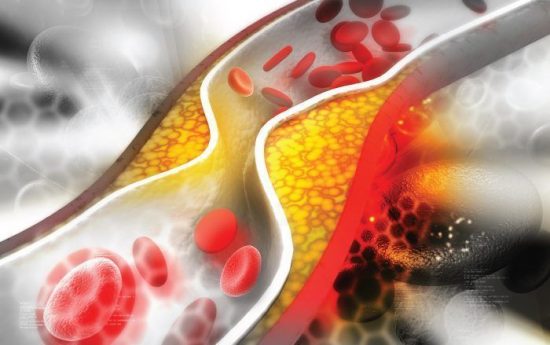 Amgen: To Evolocumab προλαμβάνει εμφράγματα και εγκεφαλικά επεισόδια