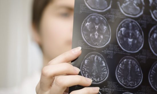Nέες θετικές εξελίξεις στην αντιμετώπιση της υποτροπιάζουσας Πολλαπλής Σκλήρυνσης