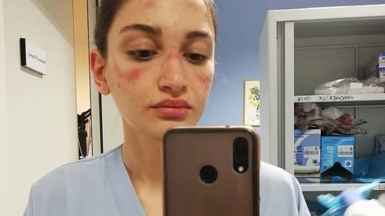 Κορονοϊός: Συγκλονιστικές φωτογραφίες από εξουθενωμένες νοσοκόμες στο Μιλάνο