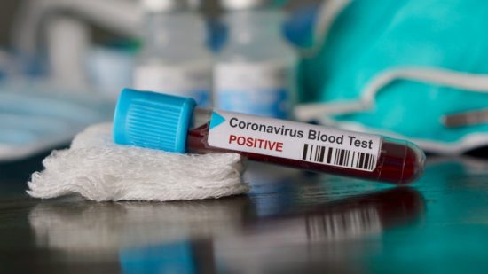 Ελβετία: Ξεκινούν οι έλεγχοι για το επίπεδο ανοσίας του πληθυσμού
