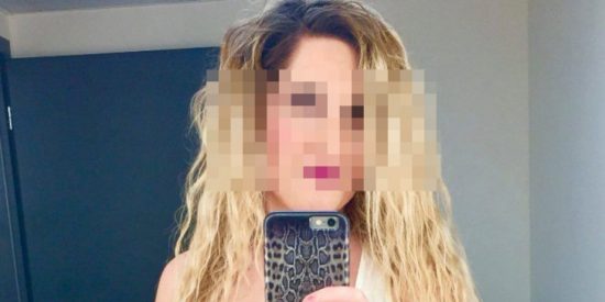 Επίθεση με βιτριόλι – Ο δικηγόρος της 34χρονης για την κατάσταση της υγείας της: «Έχει καεί το 93% του προσώπου της και το 20% του σώματός της»