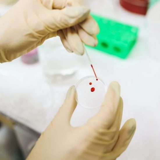 Ποια ομάδα αίματος συνδέεται περισσότερο με τις καρδιακές παθήσεις και την κακή διαχείριση άγχους