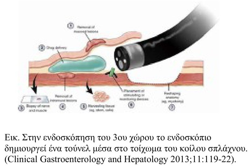 γαστρεντερολογία