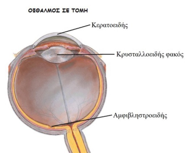 επέμβαση καταρράκτη