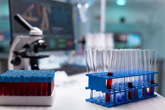 Πώς θα μειώσετε τον κίνδυνο εμφάνισης διαβητικών ελκών στα πόδια