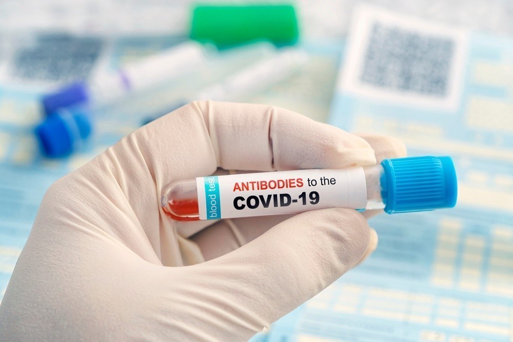 Αντισώματα COVID-19