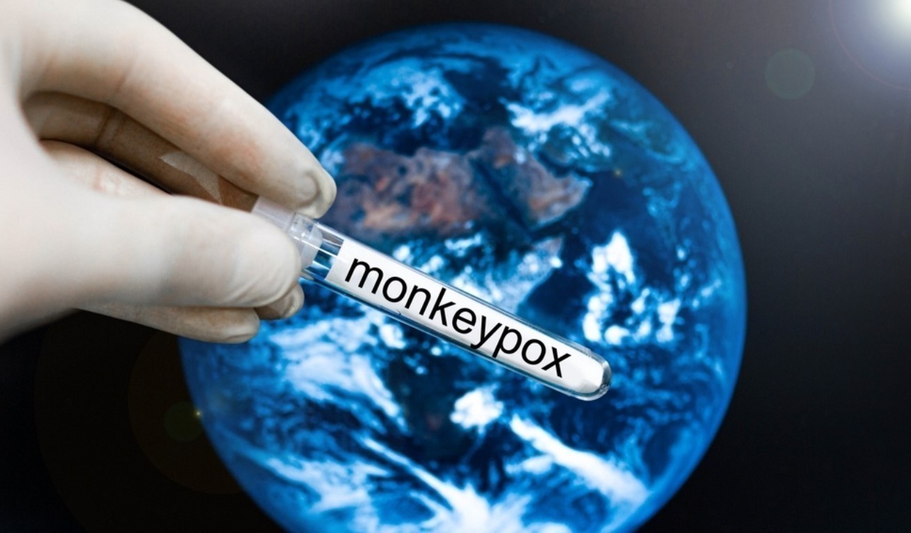 CDC: Τα επιβεβαιωμένα κρούσματα της ευλογιάς των πιθήκων ξεπέρασαν τα 1.000 σε 29 χώρες