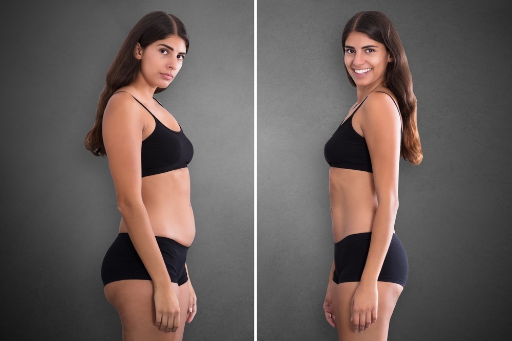 Γυναίκα κατάφερε να χάσετε λίπος στην κοιλιά χωρίς δίαιτα