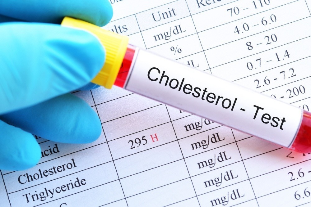 CDC: Οι 5 «χρυσοί» κανόνες για να διατηρείτε χαμηλά τη χοληστερόλη