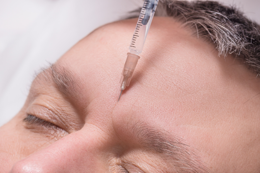 Άνδρες και botox: Εγκρίνουν οι γυναίκες;