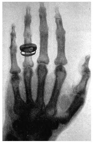 ακτινογραφία