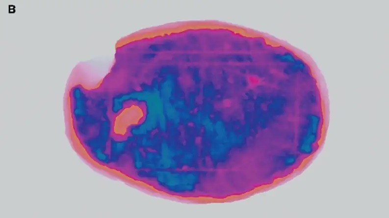 Τρισδιάστατη σάρωση του λίθου 